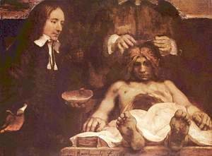 Rembrandt - The anatomy lesson of Dr. Joan Deyman (or Dr. Jan Deijman)